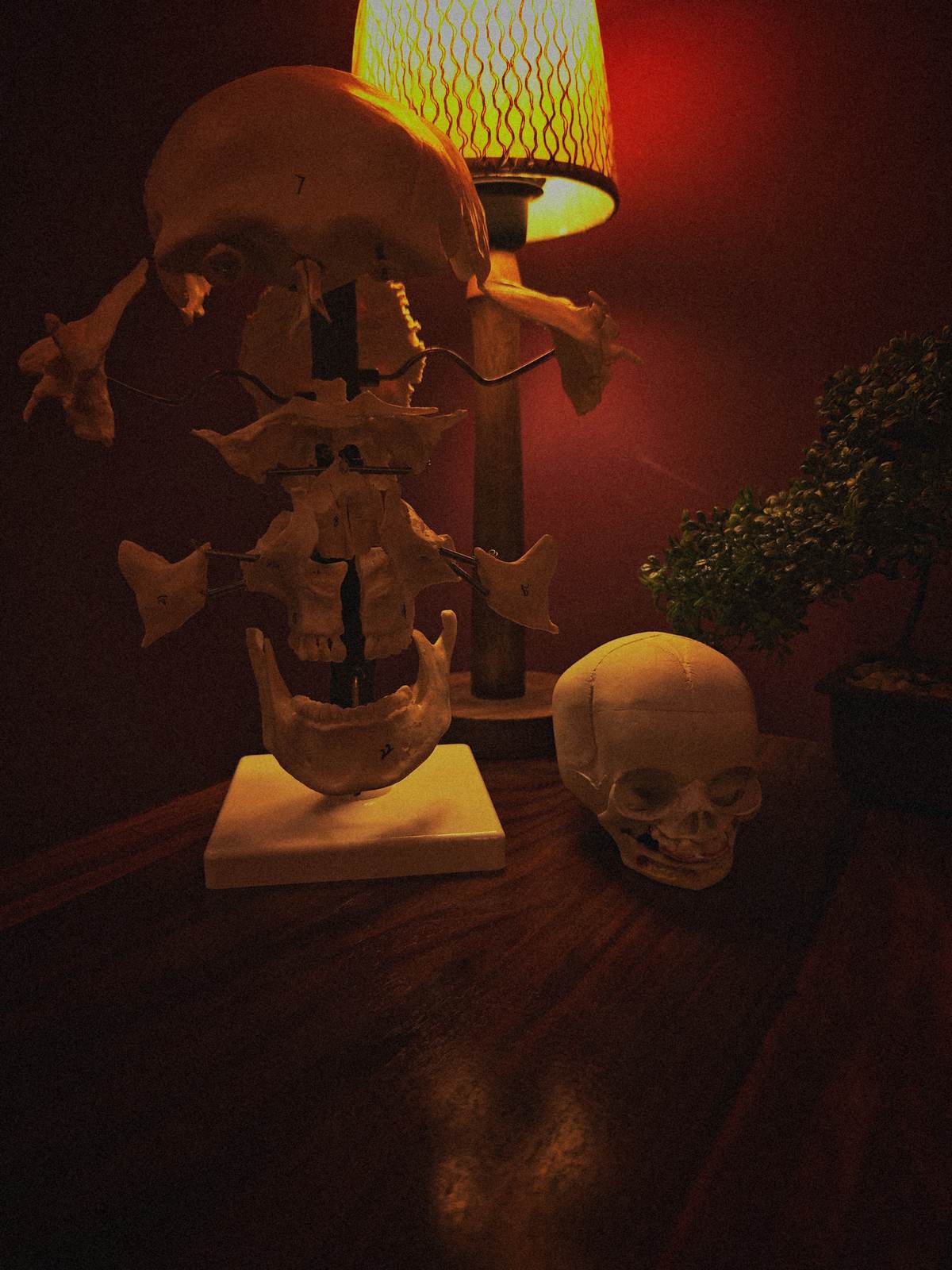 Sereñyā clinic — anatomical skull models used for patient education